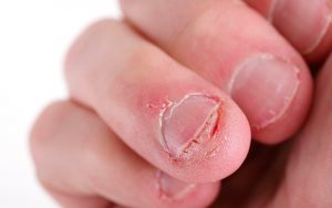 ¿Te muerdes las uñas? Te damos 3 motivos para que NO lo sigas haciendo