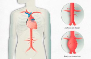 Estudio: Con mover un solo dedo podría saber si padeces una condición cardiovascular grave