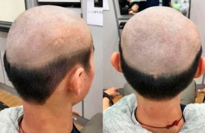 Con horrible corte de cabello, mamá evita que su hijo se contagie de Covid