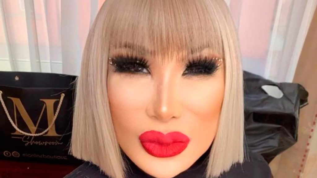¿Eres tu Lyn May? ¡Así luce la vedette tras "arreglitos" en el rostro