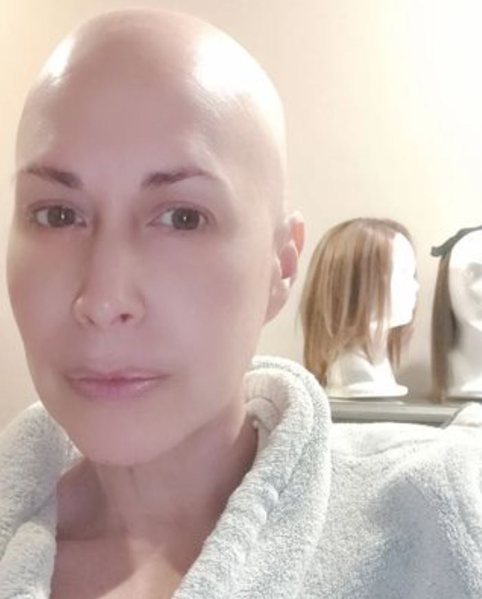 Marta Guzmán se despoja de su peluca en programa en vivo
