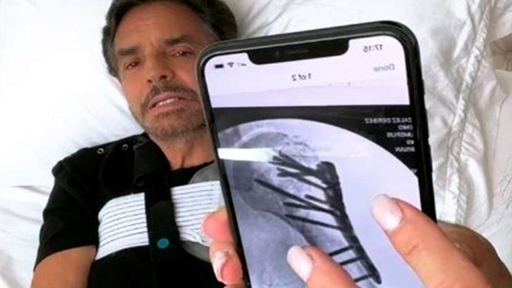 Eugenio Derbez reaparece para hablar del accidente que sufrió