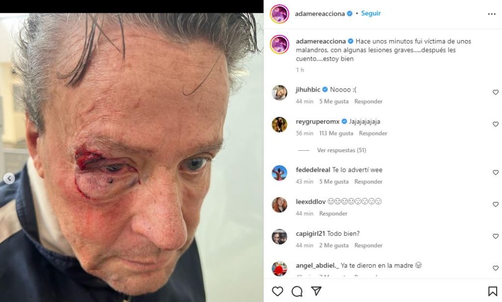 Alfredo Adame sufre brutal golpiza, podría tener desprendimiento de retina