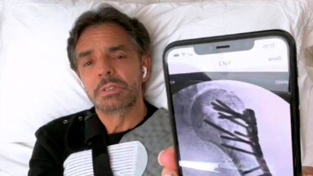 Eugenio Derbez y la dolorosa rehabilitación que enfrenta