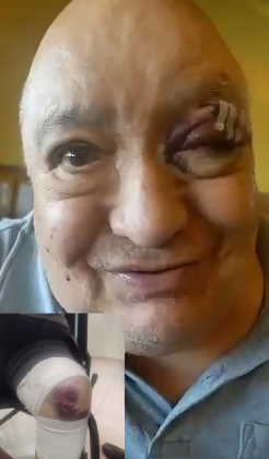 ¡Luis de Alba sufre grave accidente que lo lleva al hospital!