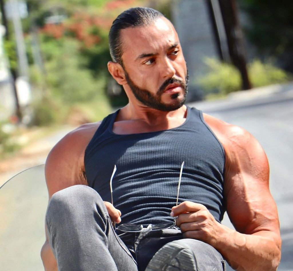 Latin Lover es sometido a delicada cirugía: "tuve miedo"