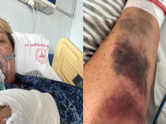 ¡Sylvia Pasquel habría sido hospitalizada de emergencia debido a una trombosis!