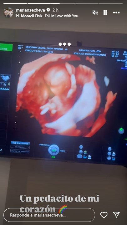 Mariana Echeverría anuncia su segundo embarazo: ¡Un milagro de amor!